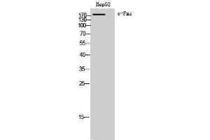Western Blotting (WB) image for anti-Colony Stimulating Factor 1 Receptor (CSF1R) (Ser275) antibody (ABIN3183879) (CSF1R anticorps  (Ser275))