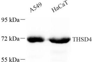 Western blot analysis of THSD4 (ABIN7075894),at dilution of 1: 200 (Thrombospondin, Type I, Domain Containing 4 (THSD4) anticorps)
