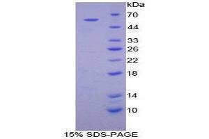 SDS-PAGE (SDS) image for Transglutaminase 1, Keratinocyte (TGM1) (AA 562-800) protein (His tag,GST tag) (ABIN2123701)