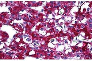 Human Adrenal: Formalin-Fixed, Paraffin-Embedded (FFPE) (PIM1 anticorps  (AA 1-100))
