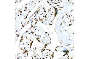 Immunohistochemistry of paraffin-embedded human placenta using RBM3 Rabbit mAb (ABIN7270084) at dilution of 1:25 (40x lens). (RBM3 anticorps)
