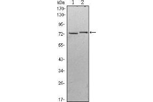 Western blot analysis using KLHL13 mouse mAb against Hela (1) and MCF-7 (2) cell lysate. (KLHL13 anticorps)
