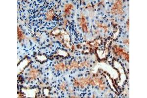 IHC-P analysis of kidney tissue, with DAB staining. (PDGF-BB Homodimer (AA 82-190) anticorps)