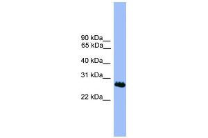WB Suggested Anti-C1orf216 Antibody Titration: 0. (C1ORF216 anticorps  (N-Term))