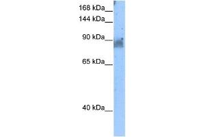 NELL2 antibody used at 5 ug/ml to detect target protein. (NELL2 anticorps)
