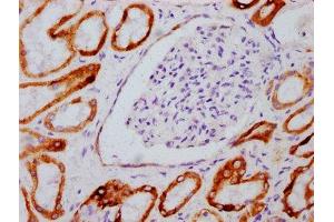 IHC image of  diluted at 1:100 and staining in paraffin-embedded human kidney tissue performed on a Leica BondTM system. (Recombinant GSK3 beta anticorps  (pSer9))