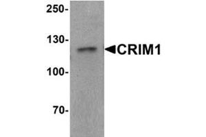 Western blot analysis of CRIM1 in Jurkat cell lysate with CRIM1 Antibody  at 1 ug/ml. (CRIM1 anticorps  (C-Term))