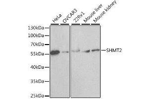 Western blot analysis of extracts of various cell lines, using SHMT2 antibody.