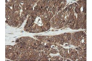 Image no. 5 for anti-Cyclin-Dependent Kinase Inhibitor 2B (p15, Inhibits CDK4) (CDKN2B) antibody (ABIN1497447)