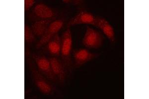 IF analysis of RTCB using anti-RTCB antibody (ABIN7600722). (C22orf28 anticorps  (AA 227-505))