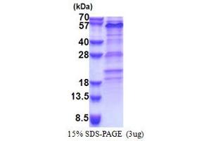 SDS-PAGE (SDS) image for Zinc Finger Protein 689 (ZNF689) (AA 1-500) protein (His tag) (ABIN5853320)