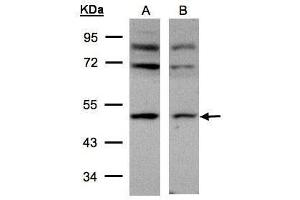 WB Image Sample(30 μg of whole cell lysate) A:293T B:HeLa S3, 10% SDS PAGE antibody diluted at 1:500 (AP2M1 anticorps  (Center))