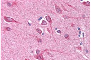 Human Brain, Cortex (formalin-fixed, paraffin-embedded) stained with BCL10 antibody ABIN214584 at 5 ug/ml followed by biotinylated goat anti-rabbit IgG secondary antibody ABIN481713, alkaline phosphatase-streptavidin and chromogen. (BCL10 anticorps  (N-Term))