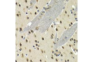 Immunohistochemistry of paraffin-embedded mouse brain using MAX antibody (ABIN5971184) at dilution of 1/200 (40x lens). (MAX anticorps)