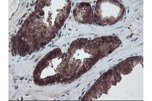 anti-RAB, Member of RAS Oncogene Family-Like 2A (RABL2A) antibody