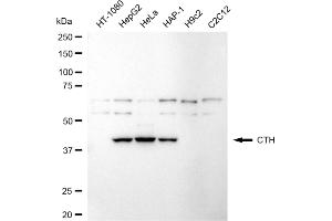 Western blotting analysis using CTH antibody (ABIN7798233). (Recombinant CTH anticorps)