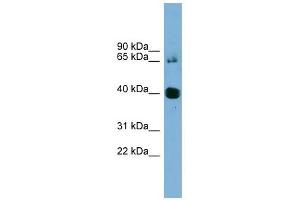 NODAL antibody used at 1 ug/ml to detect target protein. (Nodal anticorps)