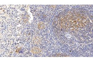 Detection of SEMA5B in Human Spleen Tissue using Monoclonal Antibody to Semaphorin 5B (SEMA5B)