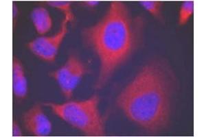Image no. 3 for anti-Adducin 1 (Alpha) (ADD1) (pSer726) antibody (ABIN196918) (alpha Adducin anticorps  (pSer726))
