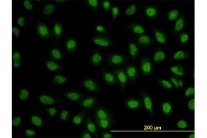 Immunofluorescence of monoclonal antibody to BCL9 on HeLa cell. (BCL9 anticorps  (AA 1036-1135))