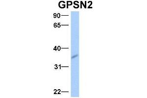 Host:  Rabbit  Target Name:  GPSN2  Sample Type:  Human Fetal Brain  Antibody Dilution:  1. (TECR anticorps  (Middle Region))