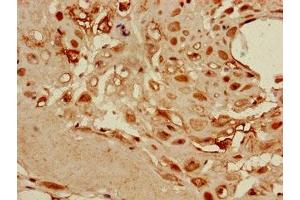 Immunohistochemistry of paraffin-embedded human placenta tissue using ABIN7149878 at dilution of 1:100 (DKK1 anticorps  (AA 33-266))