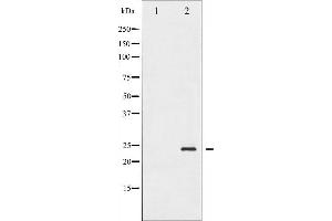 Western blot analysis of BAD phosphorylation expression in Forskolin treated 293 whole cell lysates,The lane on the left is treated with the antigen-specific peptide. (BAD anticorps  (pSer155))