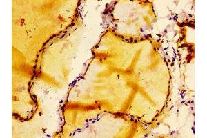 IHC image of ABIN7127273 diluted at 1:100 and staining in paraffin-embedded human thyroid tissue performed on a Leica BondTM system.