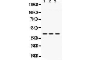 Western blot analysis of ACAA2 expression in rat lung extract ( Lane 1), mouse brain extract ( Lane 2) and HELA whole cell lysates ( Lane 3).