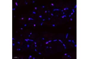 Immunofluorescence of paraffin embedded mouse skeletal muscle using SIX1 (ABIN7075617) at dilution of 1: 650 (400x lens) (SIX Homeobox 1 anticorps)