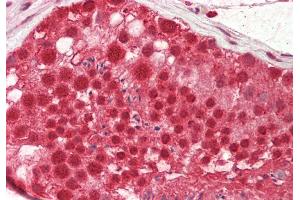 Rabbit Anti-Cstf2 antibody  Formalin Fixed Paraffin Embedded Tissue: Human Testis Primary antibody Concentration: 1:100 Secondary Antibody: Donkey anti-Rabbit-Cy3 Secondary Antibody Concentration: 1:200 Magnification: 20x Exposure Time: 0.