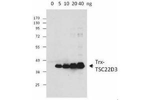 Western Blotting (WB) image for anti-Thioredoxin (TXN) antibody (ABIN2665410) (TXN anticorps)