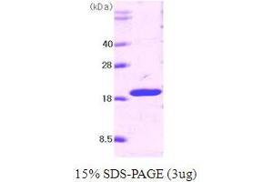 SDS-PAGE (SDS) image for Tumor Necrosis Factor (Ligand) Superfamily, Member 10 (TNFSF10) (AA 114-281) protein (ABIN666704)