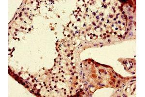 Immunohistochemistry of paraffin-embedded human testis tissue using ABIN7165750 at dilution of 1:100 (LIN28B anticorps  (AA 166-250))