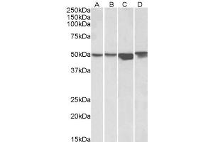 ABIN570904 (1µg/ml) staining of HEK293 (A), A431 (B), HeLa (C) and Jurkat (D) lysates (35µg protein in RIPA buffer). (ILK anticorps  (C-Term))
