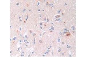 IHC-P analysis of Human Brain Tissue, with DAB staining. (BNP anticorps)