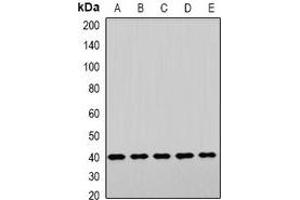 Western blot analysis of LHX6 expression in HepG2 (A), NIH3T3 (B), mouse brain (C), mouse liver (D), rat heart (E) whole cell lysates.