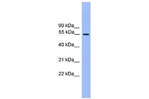 WB Suggested Anti-UBQLN2 Antibody Titration: 0. (Ubiquilin 2 anticorps  (N-Term))