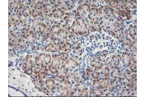 Immunohistochemical staining of paraffin-embedded Human pancreas tissue using anti-MTFMT mouse monoclonal antibody. (MTFMT anticorps  (AA 175-389))