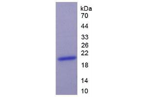 SDS-PAGE analysis of Human Keratin 9 Protein.