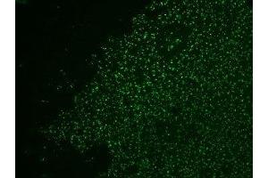 Formalin-fixed, paraffin-embedded human colon carcinoma stained with AF488 Conjugate of Nucleolin antibody.