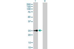 Western Blot analysis of CBX5 expression in transfected 293T cell line by CBX5 MaxPab polyclonal antibody. (CBX5 anticorps  (AA 1-191))