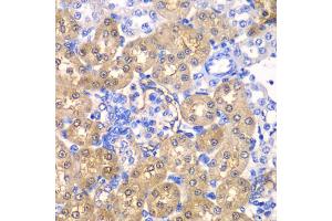 Immunohistochemistry of paraffin-embedded rat kidney using HPD antibody (ABIN5973894) at dilution of 1/100 (40x lens).