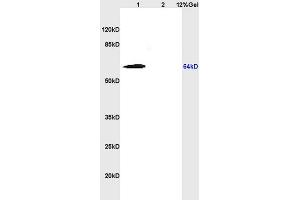 L1 rat heart lysates L2 rat heart lysates probed with Anti Cytokeratin 5/CK5 Polyclonal Antibody, Unconjugated (ABIN737061) at 1:200 overnight at 4 °C.