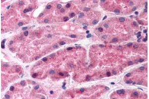 Human Kidney (formalin-fixed, paraffin-embedded) stained with REN antibody ABIN292449 at 2.