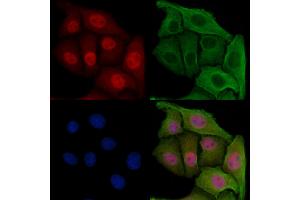 ABIN6257316 and ABIN6275218 staining Hela cells by IF/ICC. (MAD2L1BP anticorps  (N-Term))