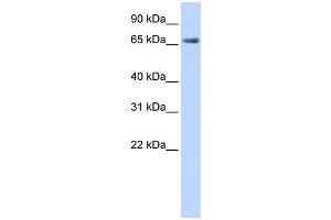WB Suggested Anti-DLG3 Antibody Titration:  0. (DLG3 anticorps  (N-Term))