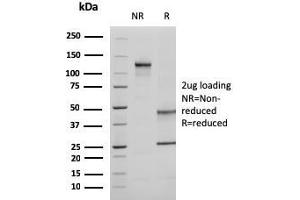 SDS-PAGE Analysis Purified Ezrin Mouse Monoclonal Antibody (CPTC-Ezrin-1).