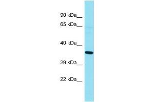 Western Blotting (WB) image for anti-G Kinase Anchoring Protein 1 (GKAP1) (N-Term) antibody (ABIN2791554) (GKAP1 anticorps  (N-Term))