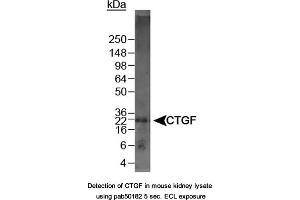 Image no. 1 for anti-Connective Tissue Growth Factor (CTGF) (C-Term) antibody (ABIN363491) (CTGF anticorps  (C-Term))